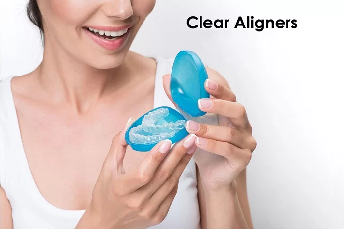 Công nghệ niềng răng trong suốt Clear Aligner đến từ Đức